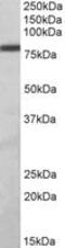 Zinc Finger And BTB Domain Containing 24 antibody, MBS423011, MyBioSource, Western Blot image 