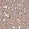 NAD(P)HX Epimerase antibody, NBP2-30943, Novus Biologicals, Immunohistochemistry paraffin image 