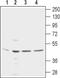 Potassium Calcium-Activated Channel Subfamily N Member 4 antibody, MA5-27547, Invitrogen Antibodies, Western Blot image 