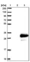 Transmembrane Protein 98 antibody, PA5-59192, Invitrogen Antibodies, Western Blot image 