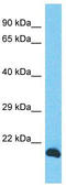 INO80 Complex Subunit C antibody, TA337356, Origene, Western Blot image 