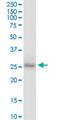 Caudal Type Homeobox 1 antibody, H00001044-M01, Novus Biologicals, Western Blot image 