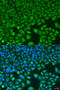 Branched Chain Keto Acid Dehydrogenase Kinase antibody, 23-450, ProSci, Immunofluorescence image 