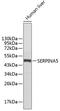 Plasma serine protease inhibitor antibody, 13-602, ProSci, Western Blot image 