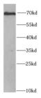Checkpoint Kinase 2 antibody, FNab01654, FineTest, Western Blot image 