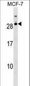 Ribonuclease A Family Member 11 (Inactive) antibody, LS-C158858, Lifespan Biosciences, Western Blot image 