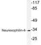 Neurexophilin 4 antibody, LS-C177480, Lifespan Biosciences, Western Blot image 