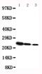 Growth Hormone 1 antibody, PA5-79308, Invitrogen Antibodies, Western Blot image 