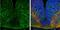EF-Hand Domain Family Member D2 antibody, NBP1-31134, Novus Biologicals, Immunohistochemistry paraffin image 