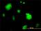 Slingshot Protein Phosphatase 3 antibody, H00054961-M01, Novus Biologicals, Immunofluorescence image 