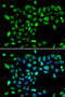 Dual Specificity Tyrosine Phosphorylation Regulated Kinase 2 antibody, STJ29092, St John