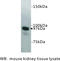 Membrane Metalloendopeptidase antibody, MBS355157, MyBioSource, Western Blot image 