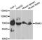 Interleukin 1 Receptor Associated Kinase 3 antibody, orb167373, Biorbyt, Western Blot image 