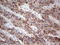 Thyroglobulin antibody, LS-C339267, Lifespan Biosciences, Immunohistochemistry frozen image 