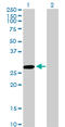 Kynurenine Aminotransferase 1 antibody, LS-B11727, Lifespan Biosciences, Western Blot image 