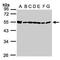 DDX39A antibody, PA5-21715, Invitrogen Antibodies, Western Blot image 