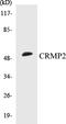 Dihydropyrimidinase Like 2 antibody, EKC1144, Boster Biological Technology, Western Blot image 