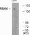 RNA Binding Motif Protein 6 antibody, PA5-38640, Invitrogen Antibodies, Western Blot image 