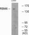 RNA Binding Motif Protein 6 antibody, PA5-38640, Invitrogen Antibodies, Western Blot image 