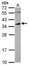 Fc Fragment Of IgG Receptor IIb antibody, PA5-29804, Invitrogen Antibodies, Western Blot image 