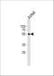 Hemogen antibody, A08422, Boster Biological Technology, Western Blot image 