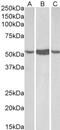 Aldehyde Dehydrogenase 1 Family Member A1 antibody, 45-238, ProSci, Enzyme Linked Immunosorbent Assay image 