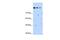 SET Domain Containing 2, Histone Lysine Methyltransferase antibody, PA5-43071, Invitrogen Antibodies, Western Blot image 