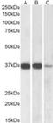 Protein Phosphatase 2 Catalytic Subunit Alpha antibody, NB100-844, Novus Biologicals, Western Blot image 