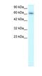 TRAF-Type Zinc Finger Domain Containing 1 antibody, NBP1-80008, Novus Biologicals, Western Blot image 