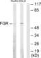 FGR Proto-Oncogene, Src Family Tyrosine Kinase antibody, LS-C118770, Lifespan Biosciences, Western Blot image 