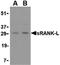 TNF Superfamily Member 11 antibody, LS-B1425, Lifespan Biosciences, Western Blot image 