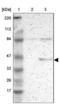 Ribosomal Protein L3 antibody, NBP1-81332, Novus Biologicals, Western Blot image 
