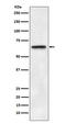 ATP Binding Cassette Subfamily E Member 1 antibody, M04173, Boster Biological Technology, Western Blot image 