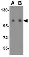 Anoctamin 2 antibody, GTX85241, GeneTex, Western Blot image 