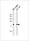 Probable gluconokinase antibody, M15308, Boster Biological Technology, Western Blot image 