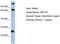 TBC1 Domain Family Member 7 antibody, TA345016, Origene, Western Blot image 