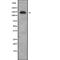 Adhesion G Protein-Coupled Receptor A2 antibody, abx215684, Abbexa, Western Blot image 