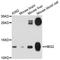 Hemoglobin Subunit Gamma 2 antibody, A11828, ABclonal Technology, Western Blot image 