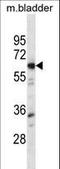 LYN Proto-Oncogene, Src Family Tyrosine Kinase antibody, LS-C164441, Lifespan Biosciences, Western Blot image 