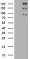 ALK Receptor Tyrosine Kinase antibody, TA801268AM, Origene, Western Blot image 