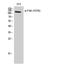 Protein Tyrosine Kinase 2 antibody, A00151Y576, Boster Biological Technology, Western Blot image 