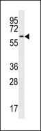 Cell Division Cycle 14A antibody, MBS9211183, MyBioSource, Western Blot image 