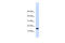 Pleckstrin Homology Like Domain Family A Member 3 antibody, ARP54891_P050, Aviva Systems Biology, Western Blot image 