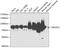 NADH:Ubiquinone Oxidoreductase Core Subunit S1 antibody, GTX32742, GeneTex, Western Blot image 