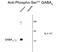 Gamma-Aminobutyric Acid Type A Receptor Gamma2 Subunit antibody, GTX31012, GeneTex, Western Blot image 