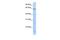 TBC1 Domain Family Member 22A antibody, GTX45341, GeneTex, Western Blot image 