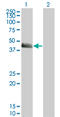 Serpin Family E Member 1 antibody, LS-C197840, Lifespan Biosciences, Western Blot image 