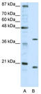 Zinc Finger Protein 322 antibody, TA345393, Origene, Western Blot image 