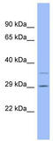 Coagulation Factor XII antibody, TA346198, Origene, Western Blot image 
