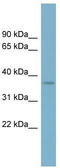 Sad1 And UNC84 Domain Containing 5 antibody, TA344295, Origene, Western Blot image 